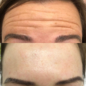 Aesthetics treatments at Bellissima Clinic, Clapham, London